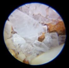Customer photo review of Montessori Microscope™ - Pocket Microscope