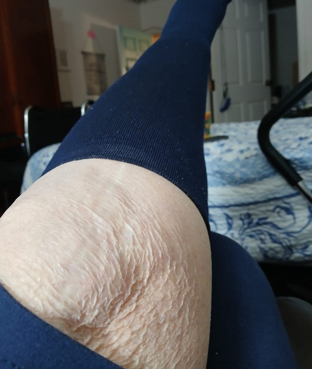 Customer photo review of Bamboo Navy Compression Socks