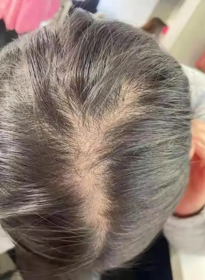 Customer photo review of AQUALYA Korean Hair Serum – Stronger-Looking Hair from the Roots