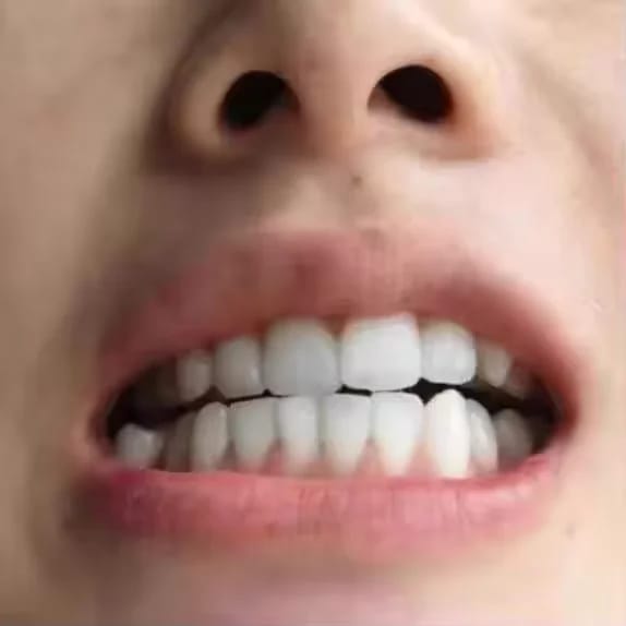 Customer photo review of Teeth Whitener – For a Brighter-Looking Smile