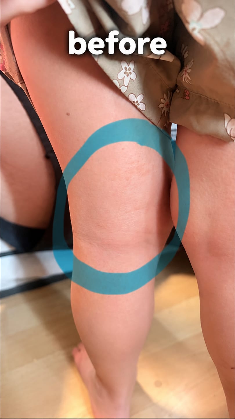 Customer photo review of Extra Strength Salve