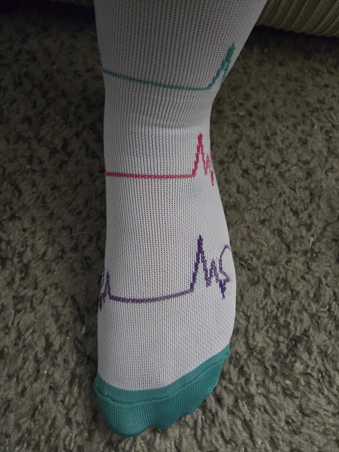 Customer photo review of Blush Lovebeat Compression Socks