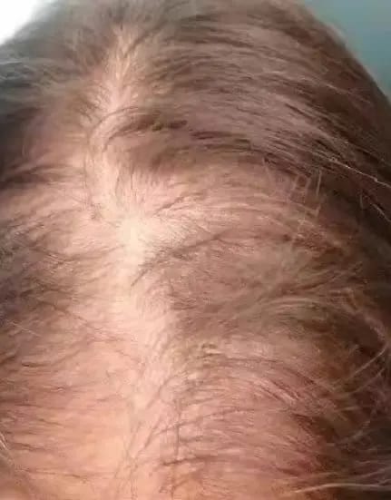 Customer photo review of AQUALYA Korean Hair Serum – Stronger-Looking Hair from the Roots