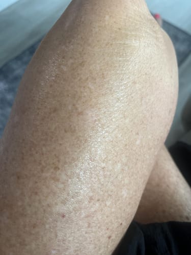 Customer photo review of NØRD BODY Peptide Body Oil