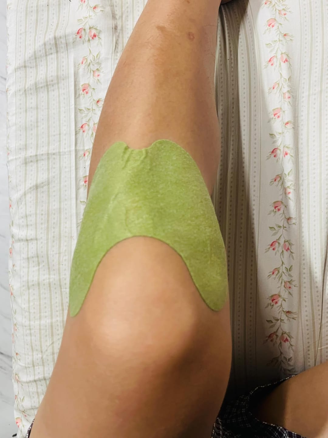 Customer photo review of Herbal Knee Pain Relief Patches