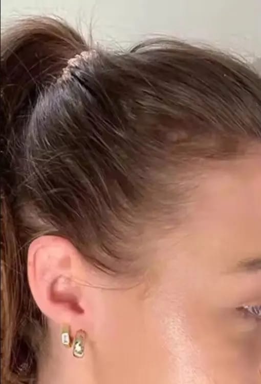 Customer photo review of AQUALYA Korean Hair Serum – Stronger-Looking Hair from the Roots