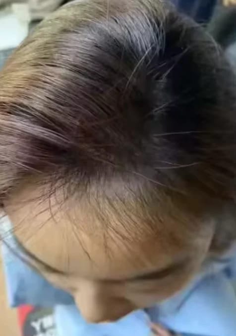 Customer photo review of AQUALYA Korean Hair Serum – Stronger-Looking Hair from the Roots