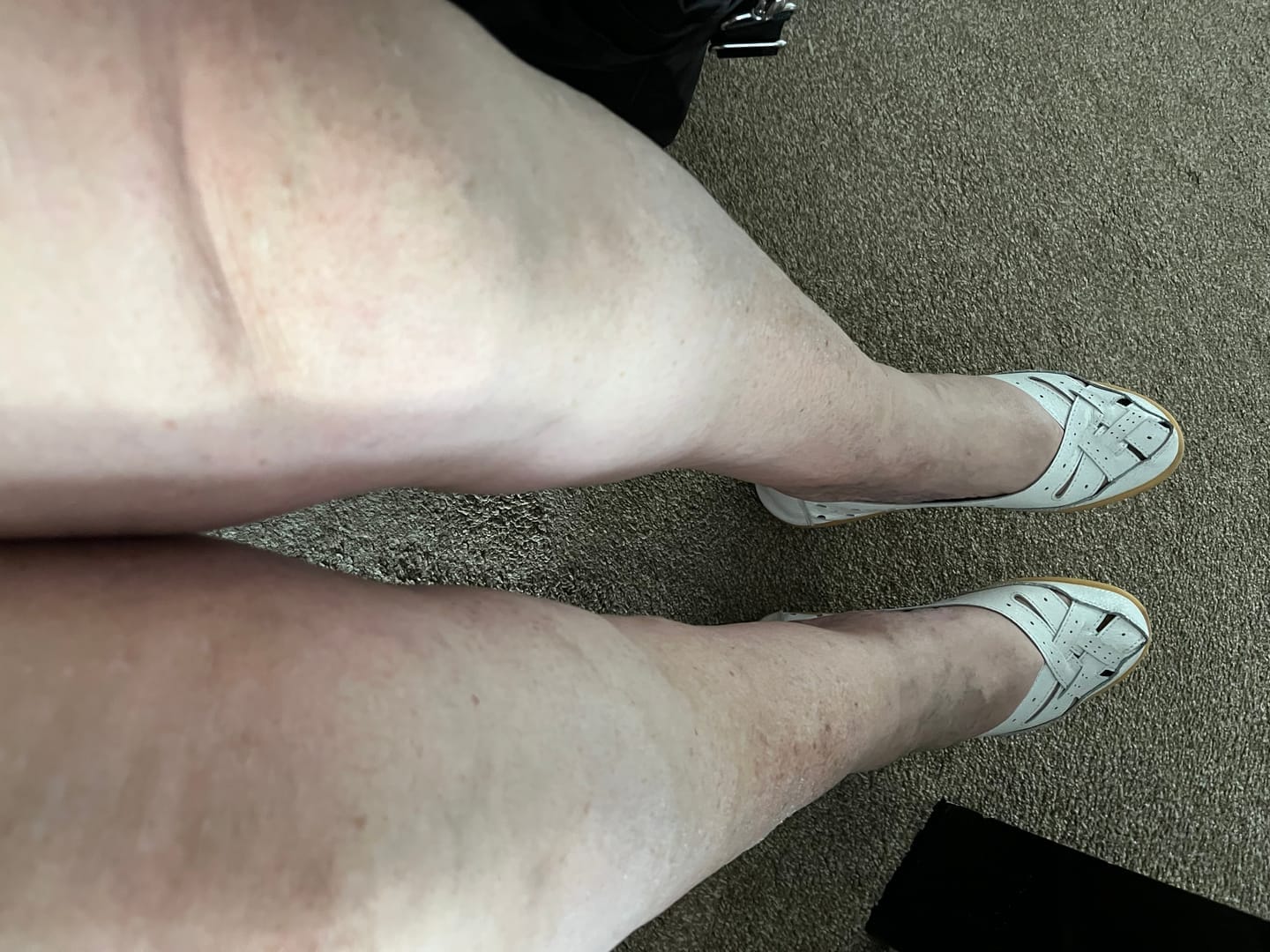 Customer photo review of Polka Dot Compression Socks