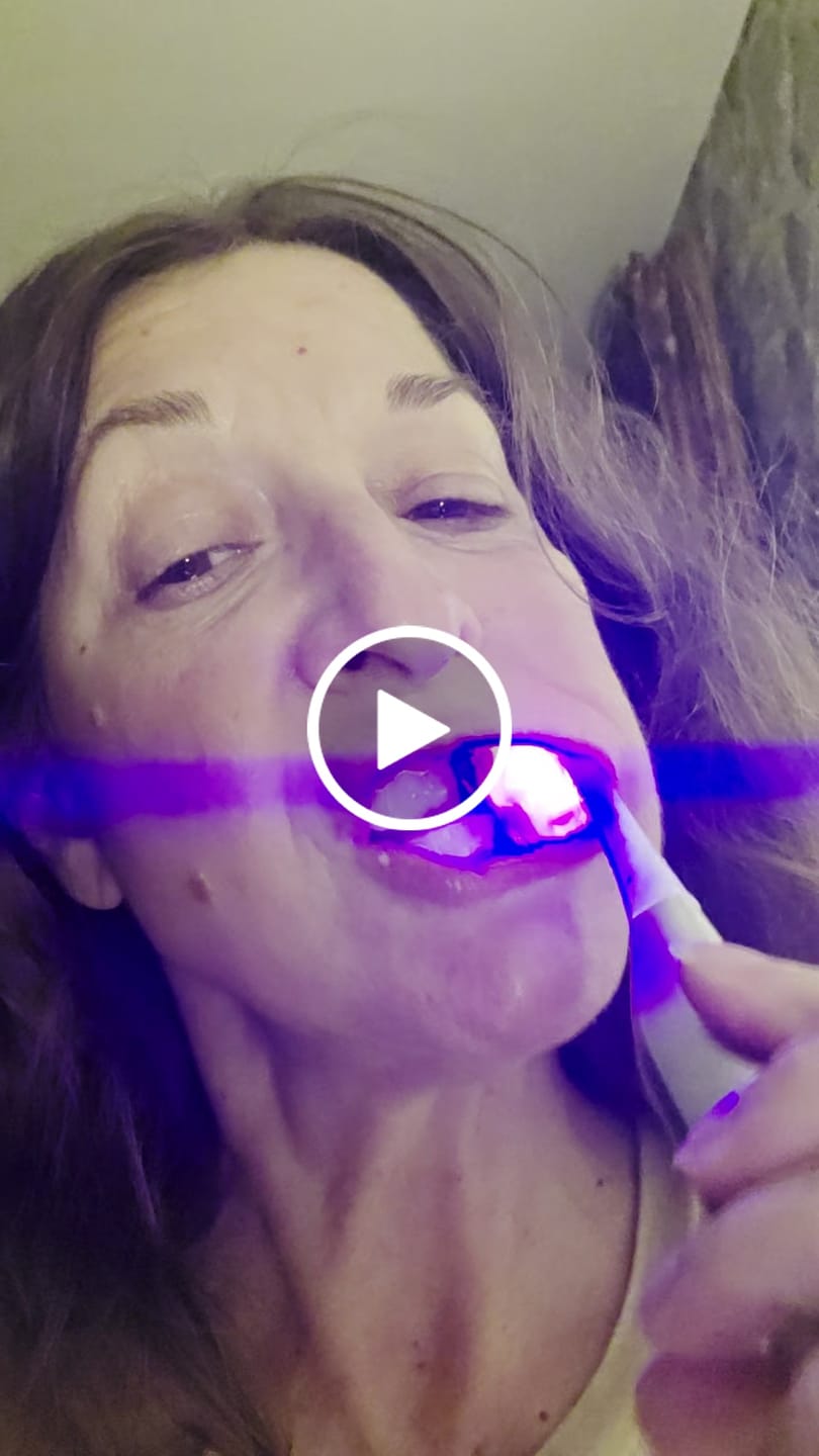 Customer video review of Red & Blue Light Therapy Sonic Toothbrush for Gum Health & Teeth Whitening - Oralucent Pro Edition