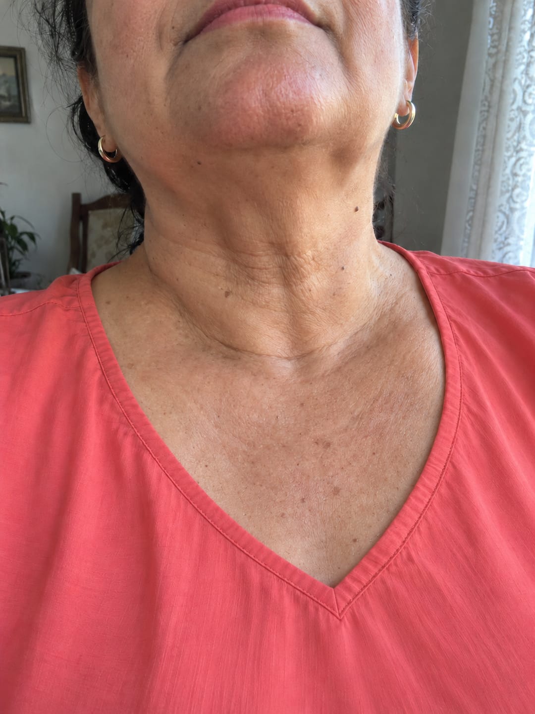 Customer photo review of Koriderm · Crema antiedad con Centella