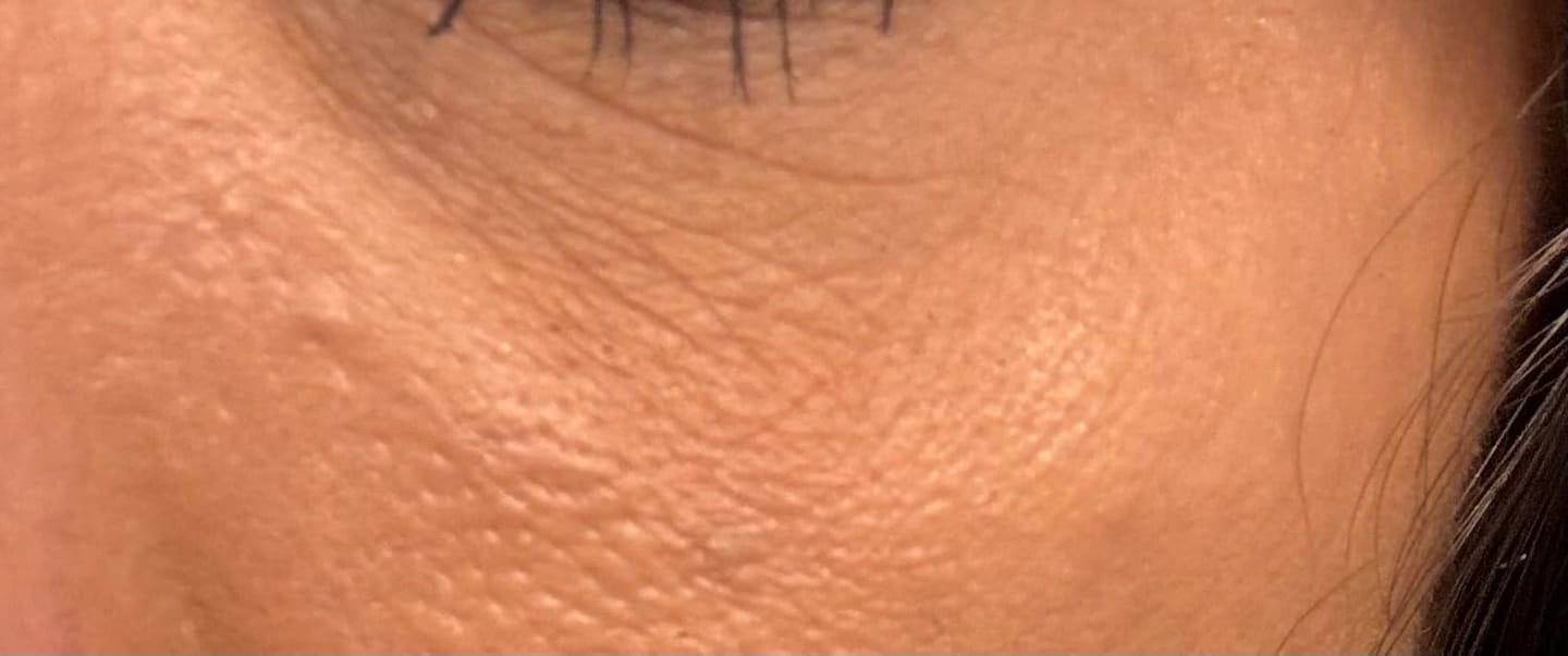 Customer photo review of Bright Eye Cream