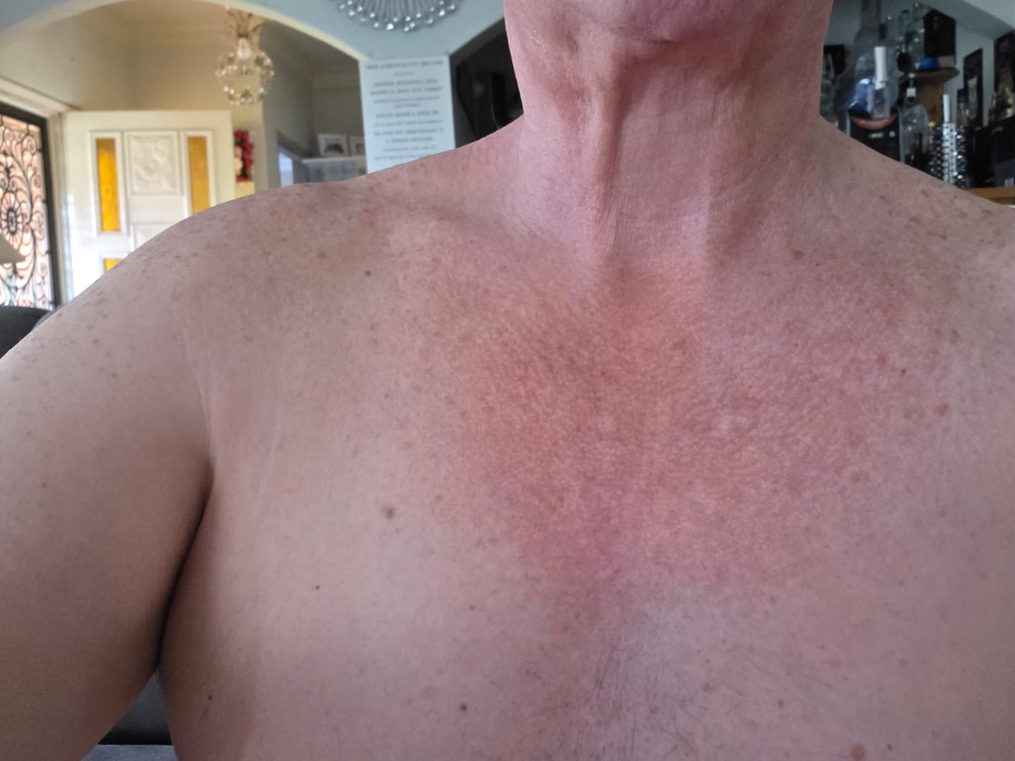 Customer photo review of NØRD BODY Peptide Body Oil