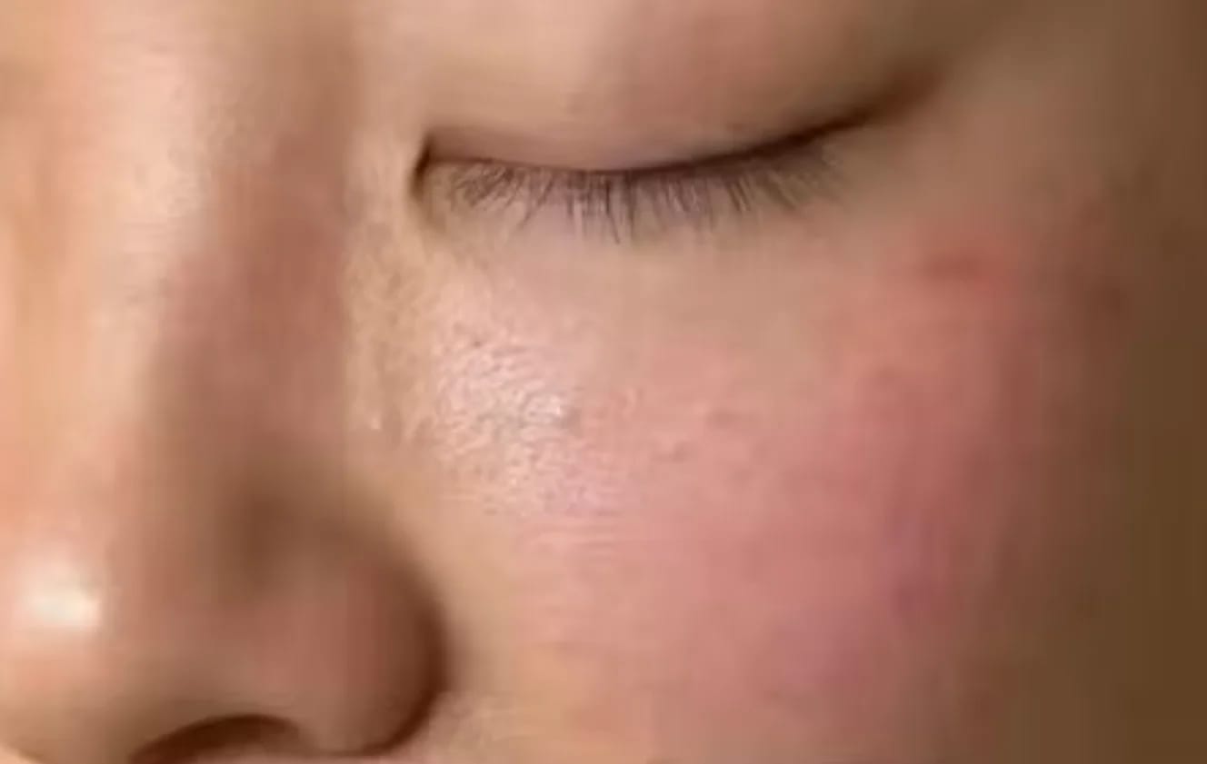Customer photo review of PINK GLOW SERUM