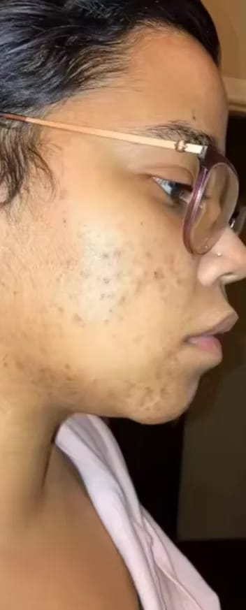 Customer photo review of PINK GLOW SERUM