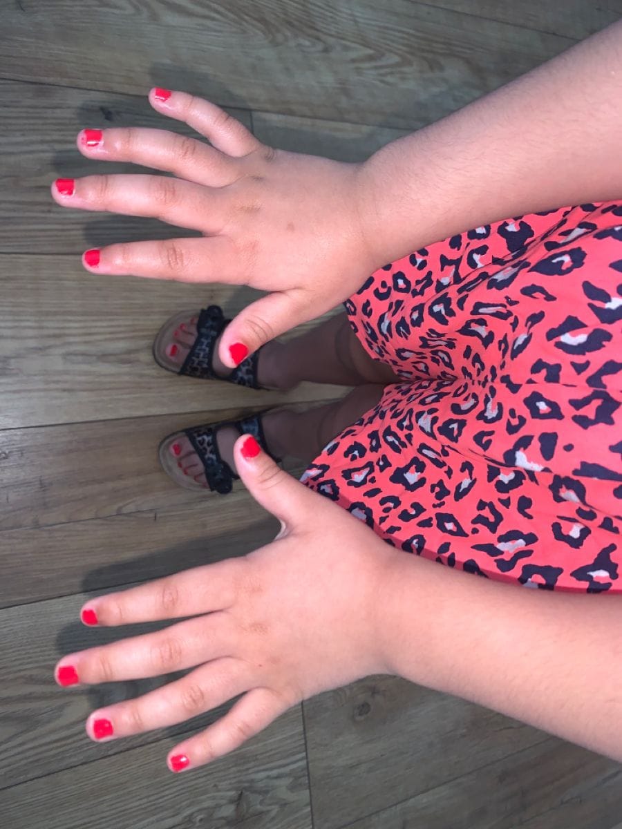 Customer photo review of Marcadores de uñas para niñas