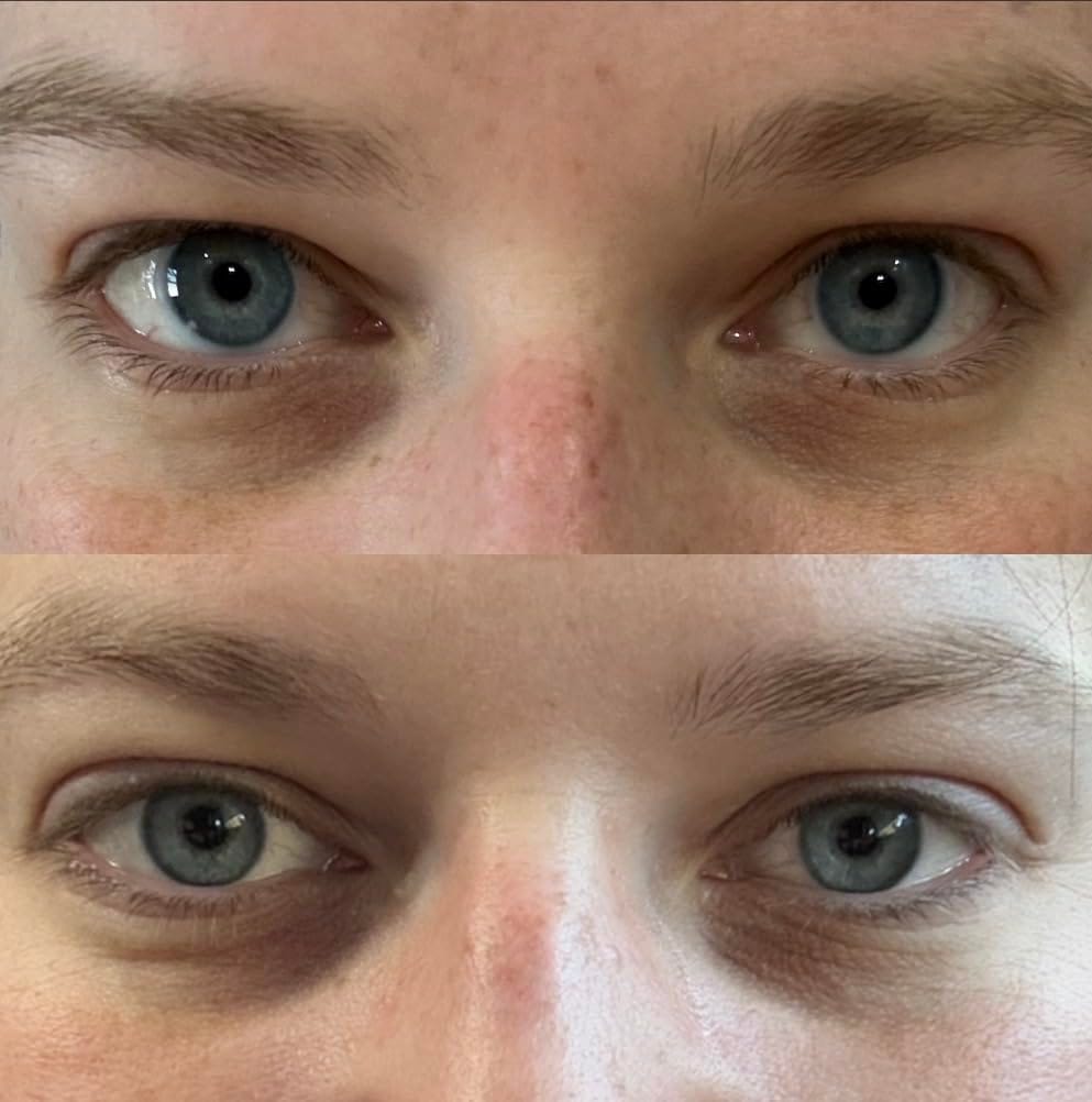 Customer photo review of Bright Eye Cream