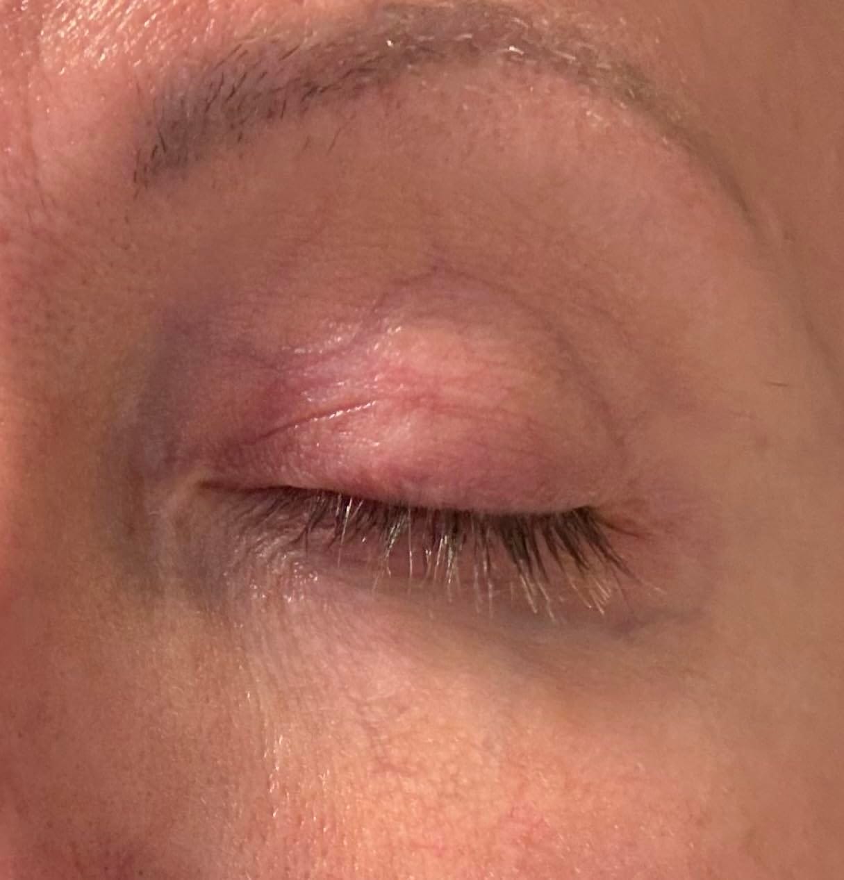 Customer photo review of Bright Eye Cream