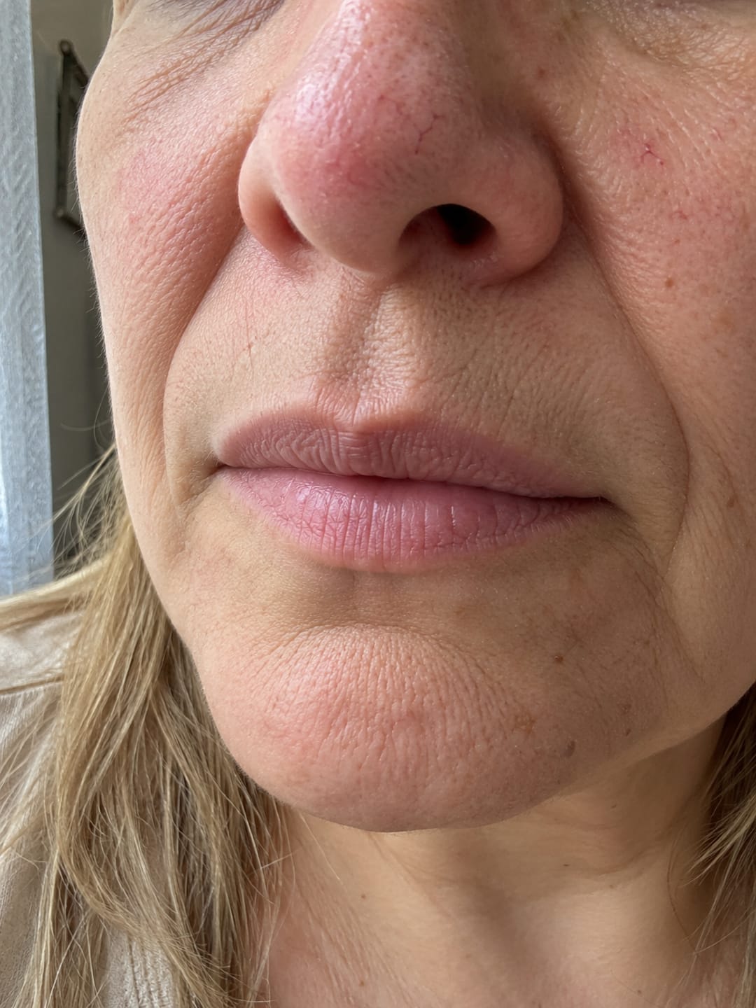 Customer photo review of Koriderm · Crema antiedad con Centella