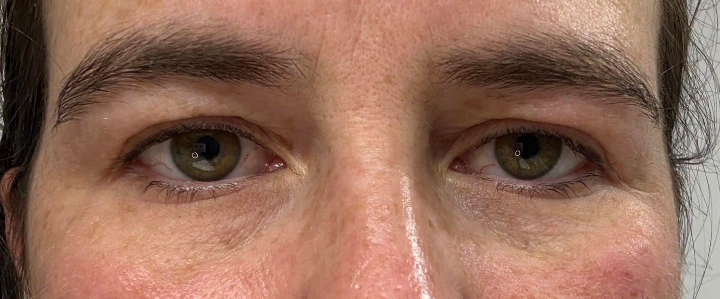 Customer photo review of Bright Eye Cream