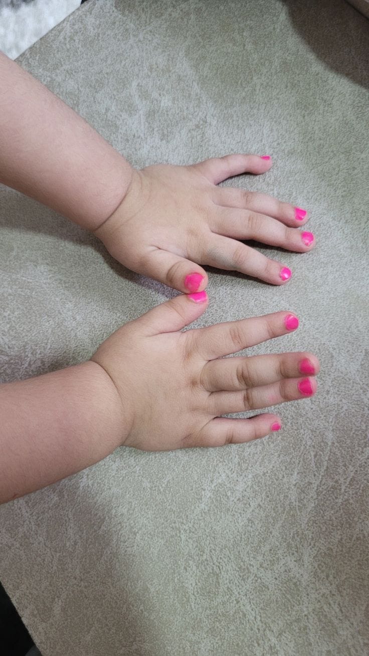 Customer photo review of Marcadores de uñas para niñas