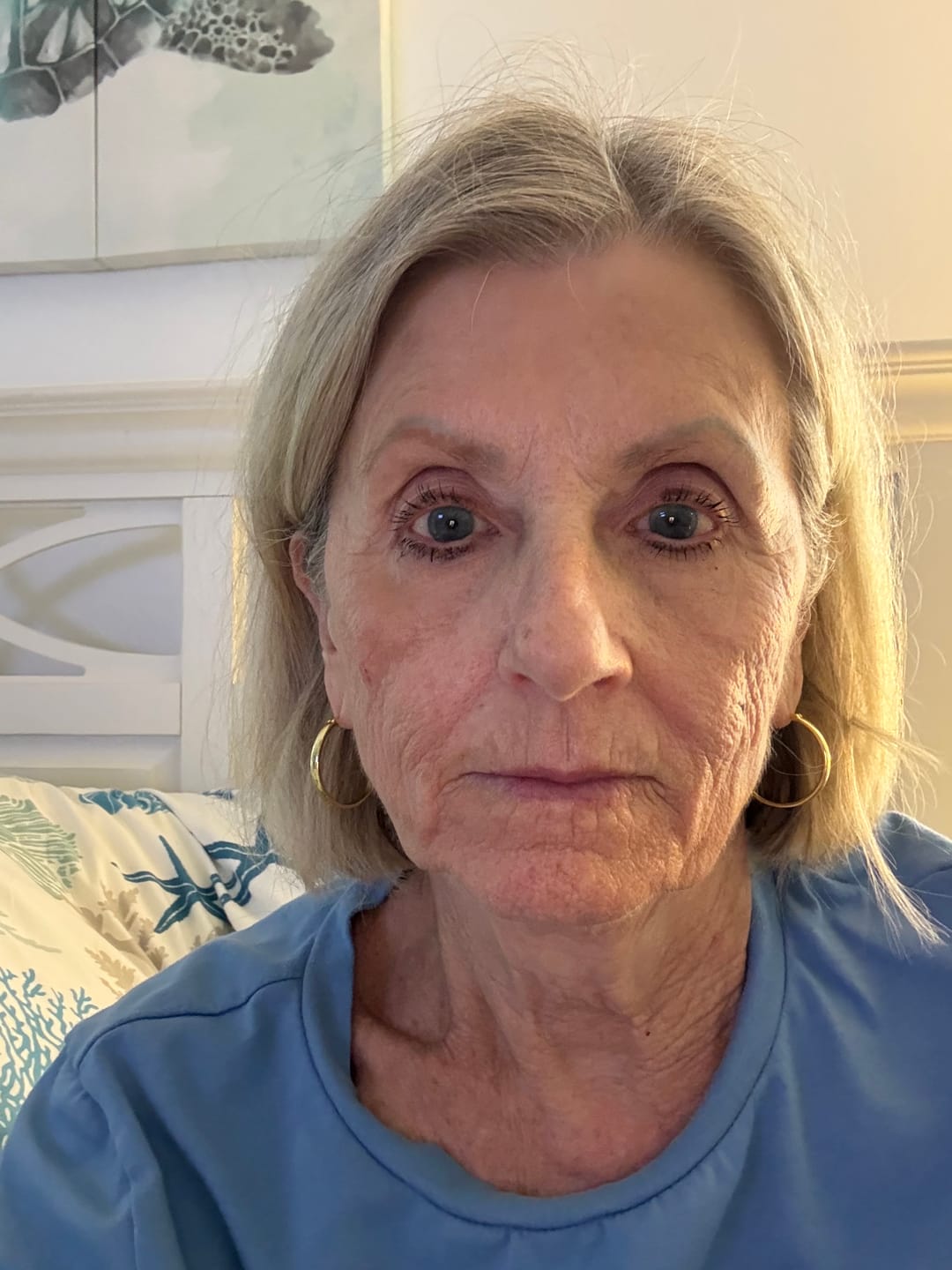Customer photo review of Deep Collagen Cream