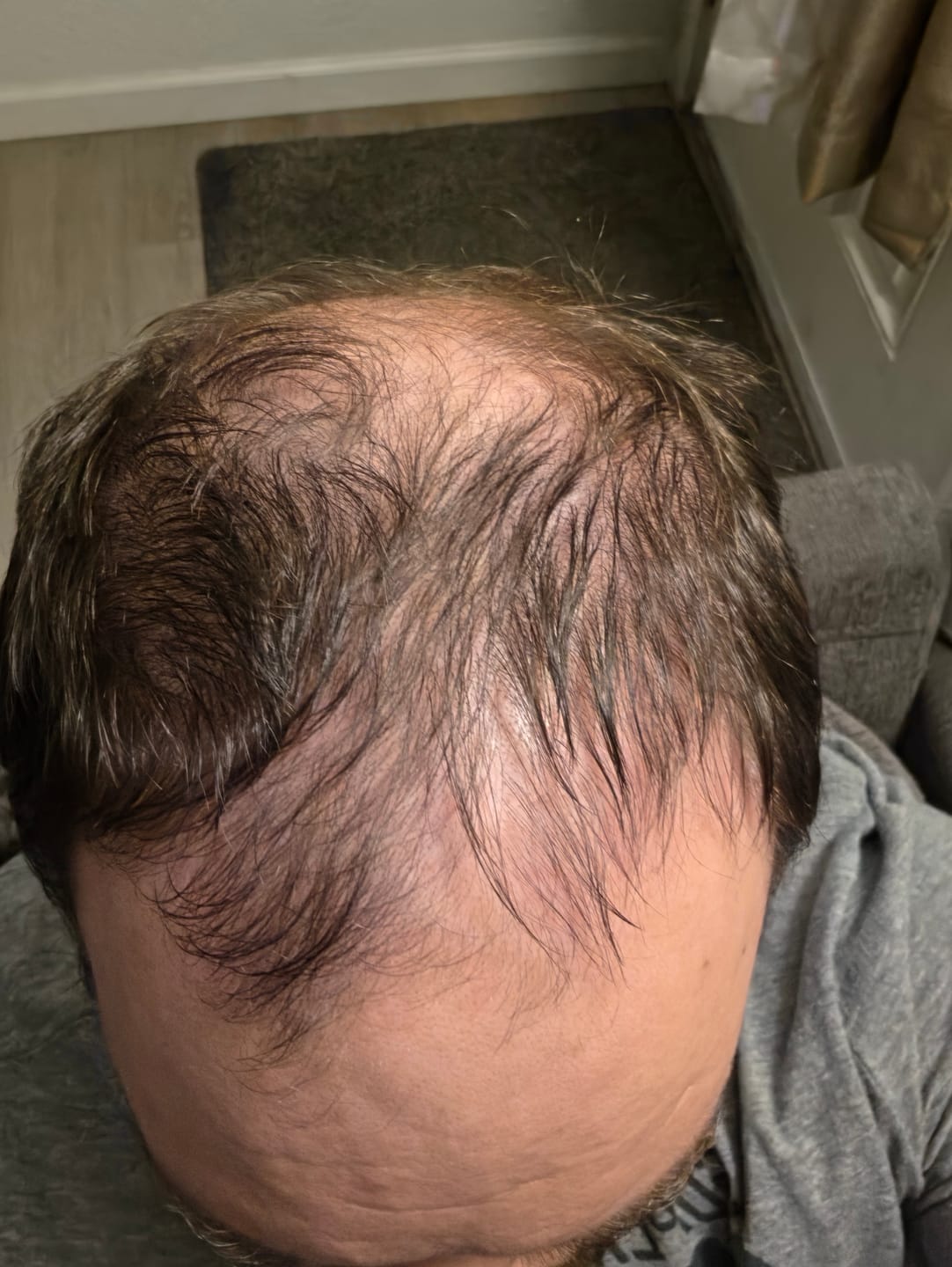 Customer photo review of Spartan™ Root Activator Shampoo 6 Bottles(sc)