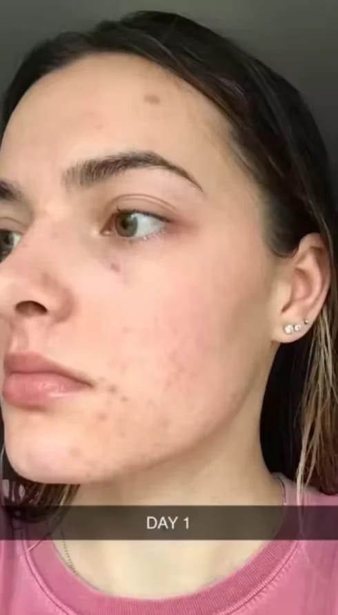Customer photo review of PINK GLOW SERUM