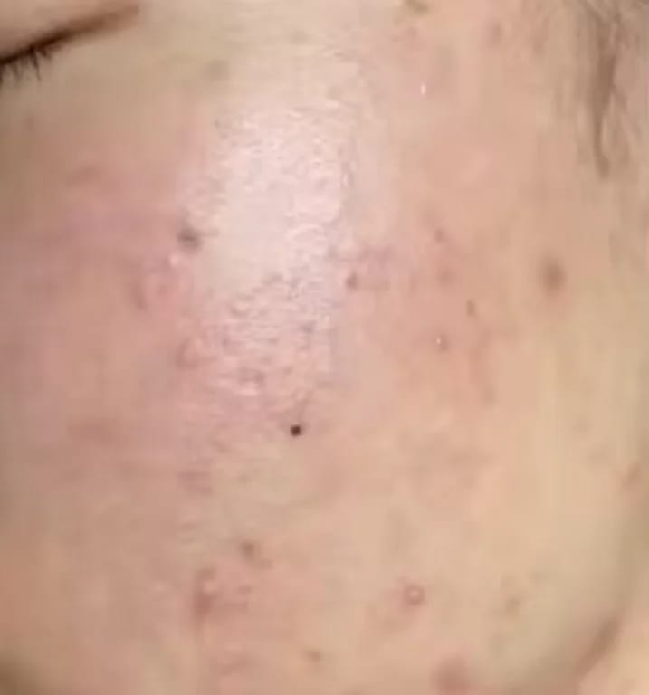 Customer photo review of PINK GLOW SERUM