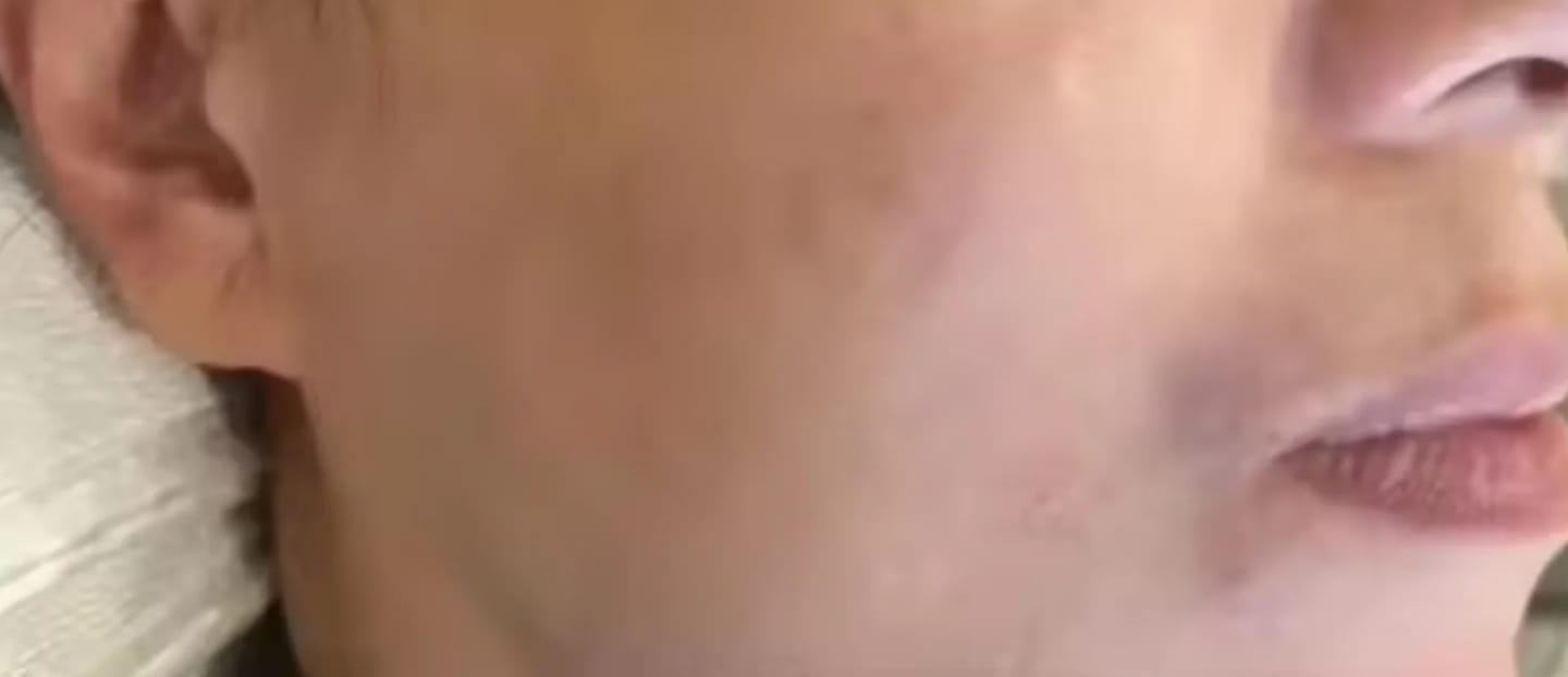 Customer photo review of PINK GLOW SERUM