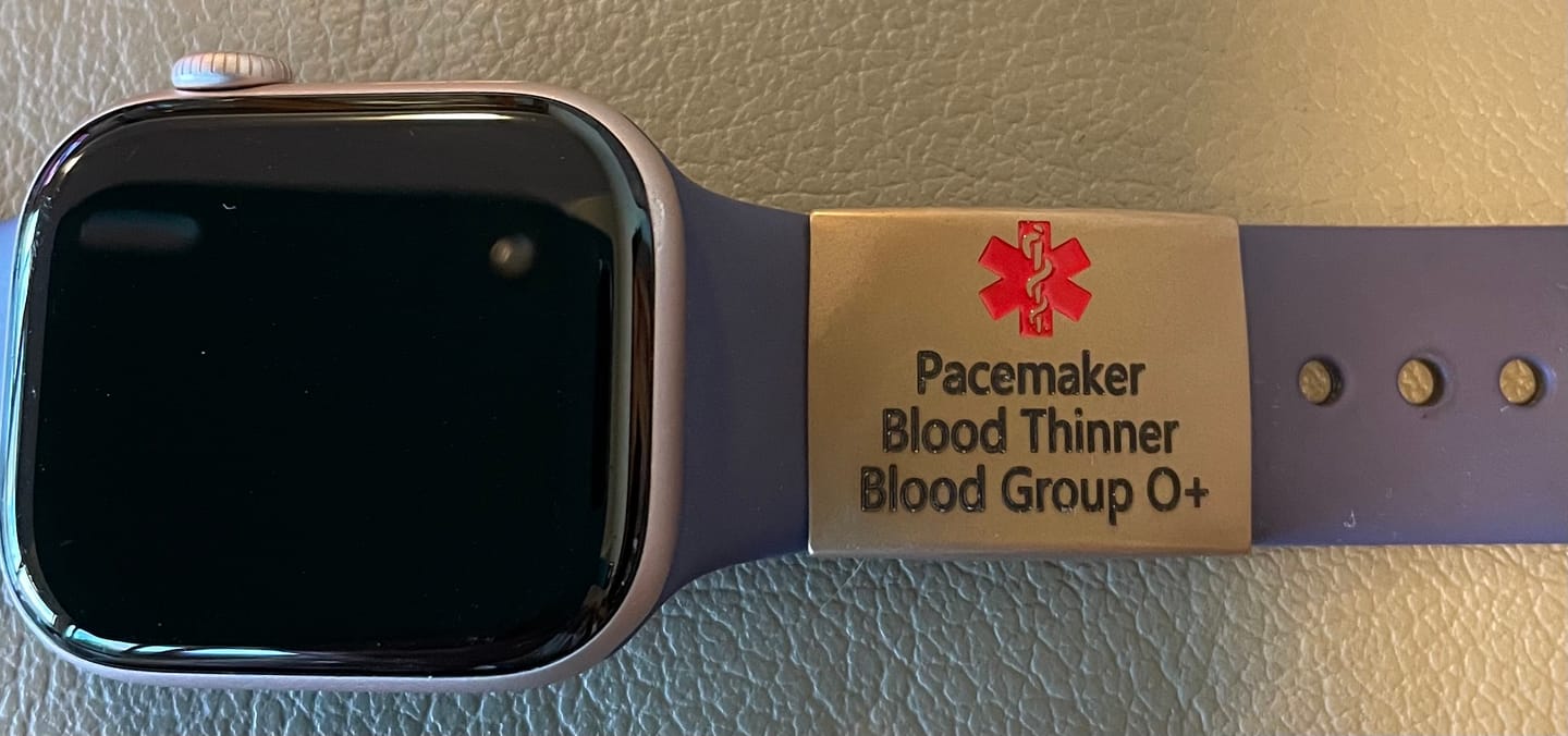 Customer photo review of Personalised ID Tag for Watch Band & Fitness Trackers