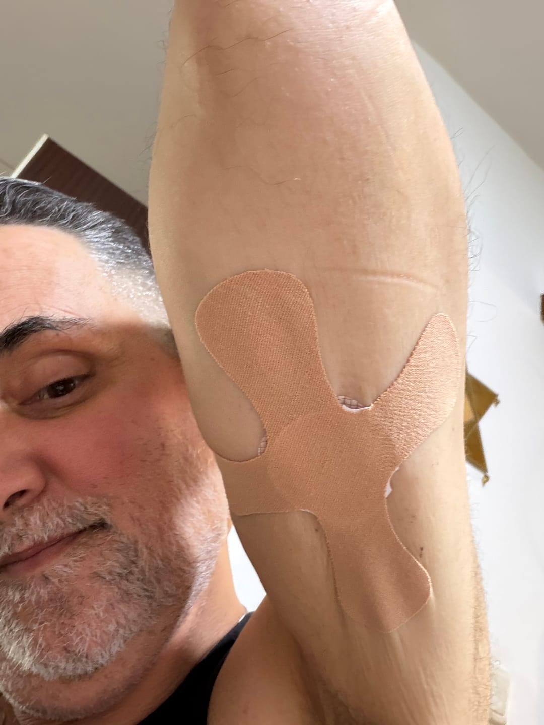 Customer photo review of Original Patch גוף 20 יח׳