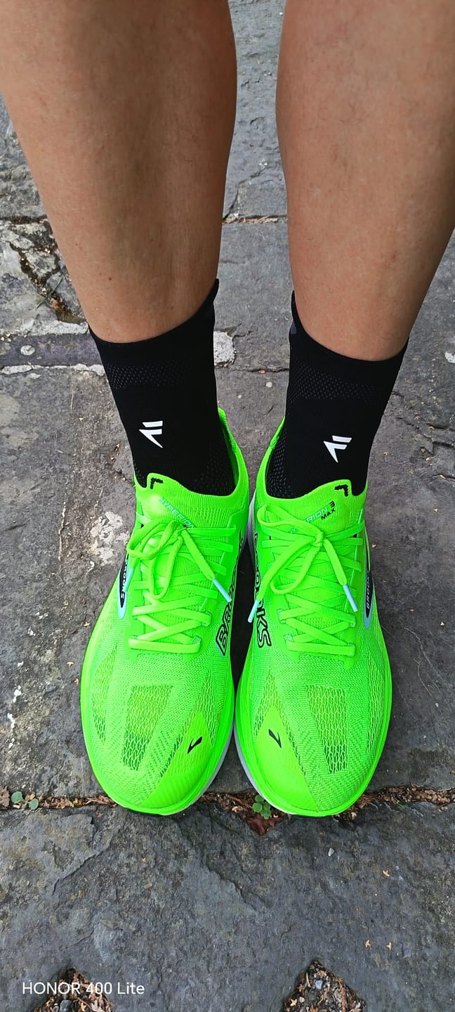 Customer photo review of Maintien de Compression pour Chevilles V3