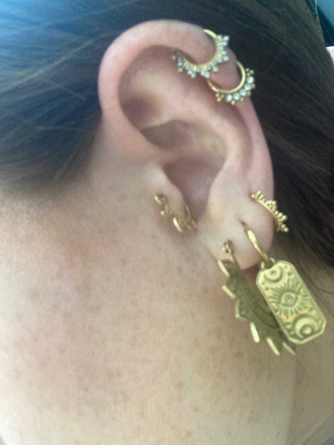 Customer photo review of Gold Lotus Huggies