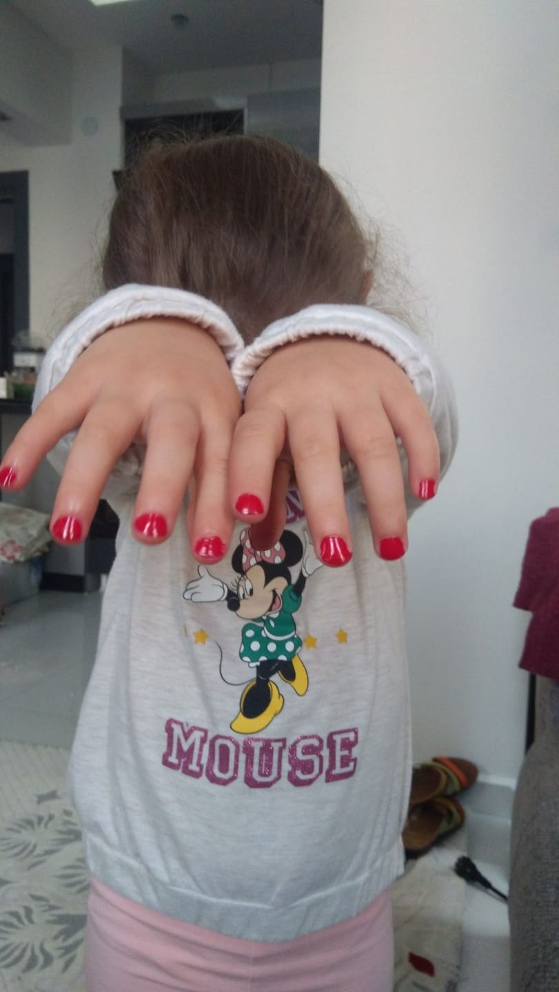 Customer photo review of Marcadores de uñas para niñas