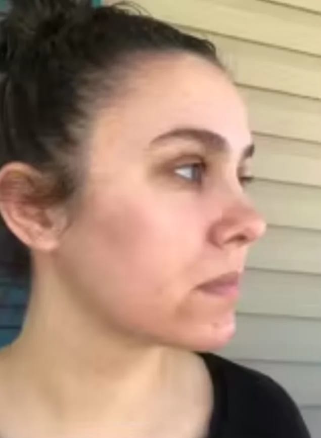 Customer photo review of PINK GLOW SERUM