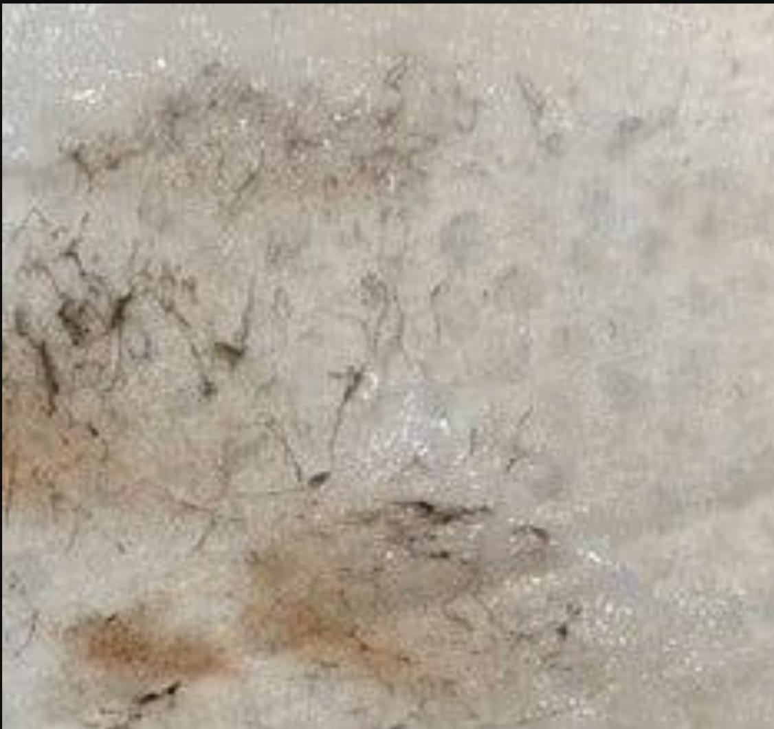 Customer photo review of Facial Hair Removal Kit