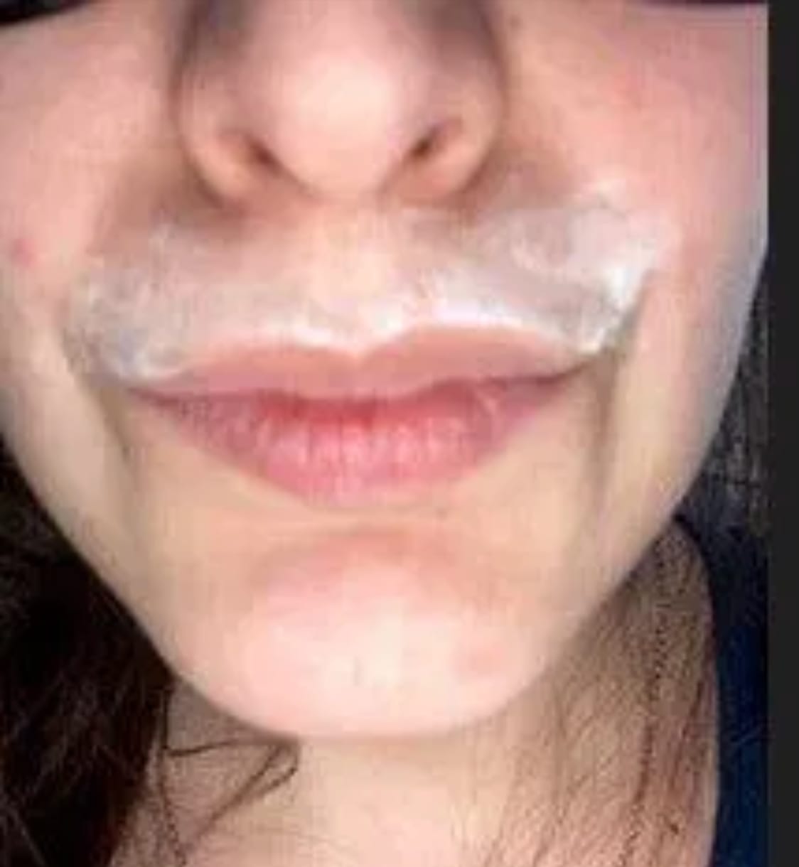 Customer photo review of Facial Hair Removal Kit