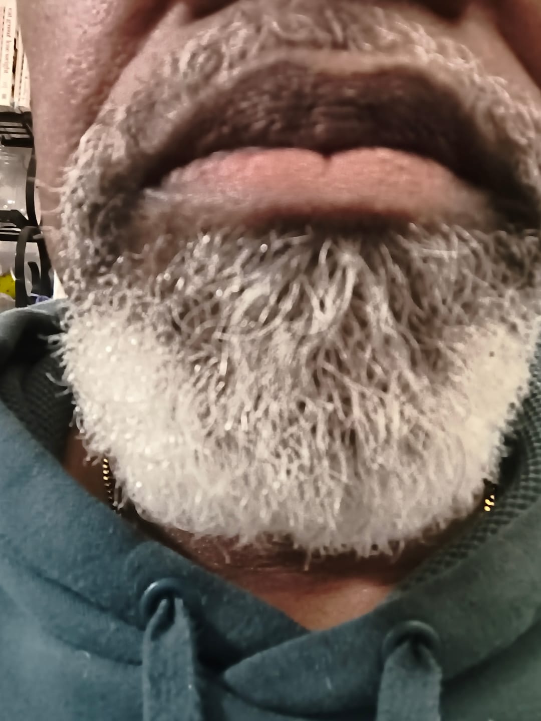 Customer photo review of Men’s Healthy Hair & Beard Starter Kit