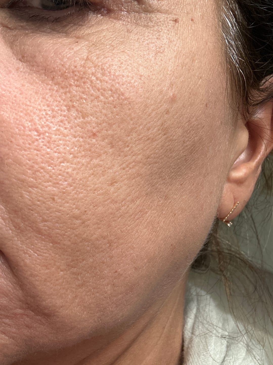 Customer photo review of Siero Viso Acido Ialuronico + Vitamina C