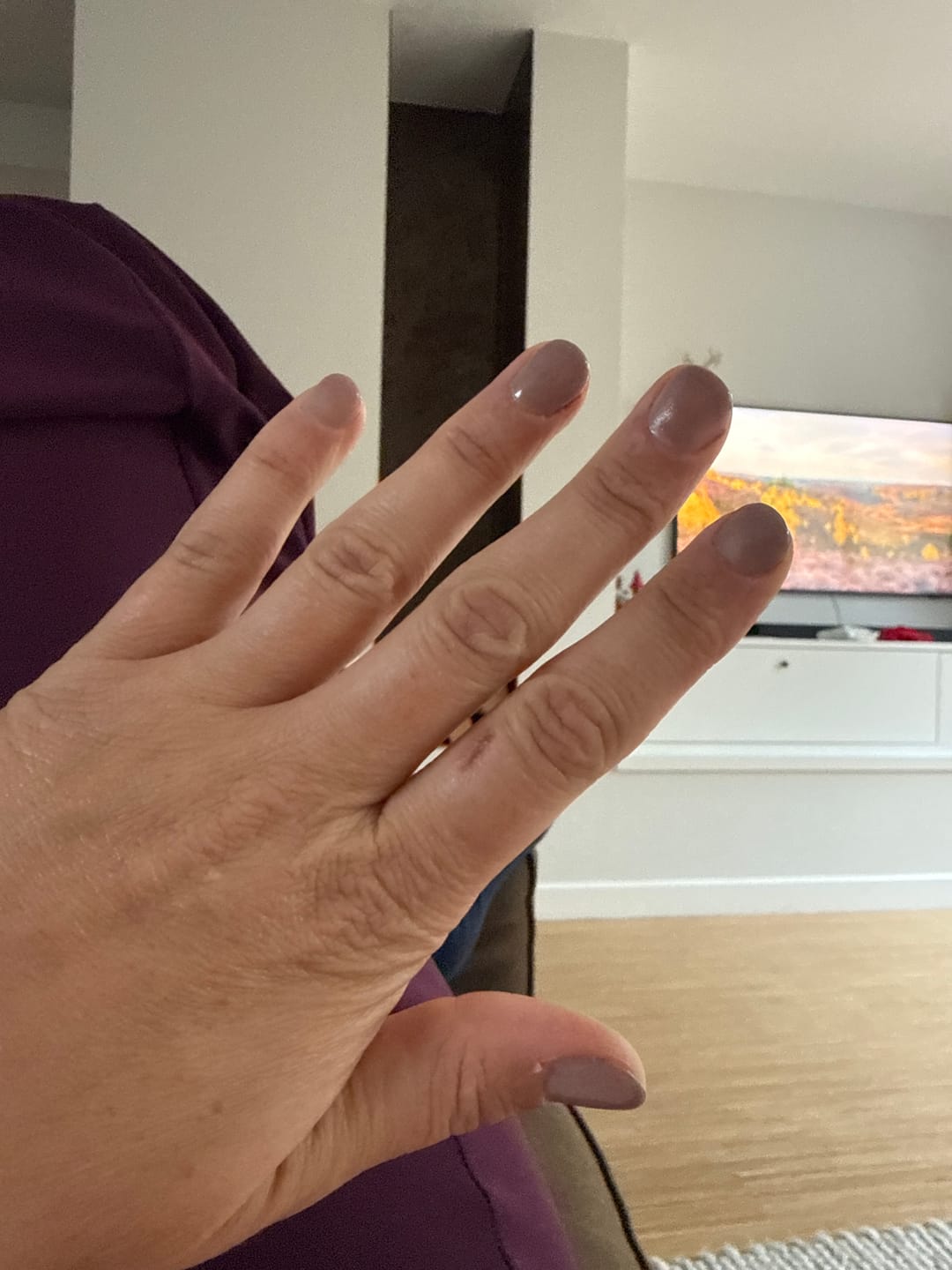 Customer photo review of Verwijder Basics + 4 Kleuren | Voordeel Bundel