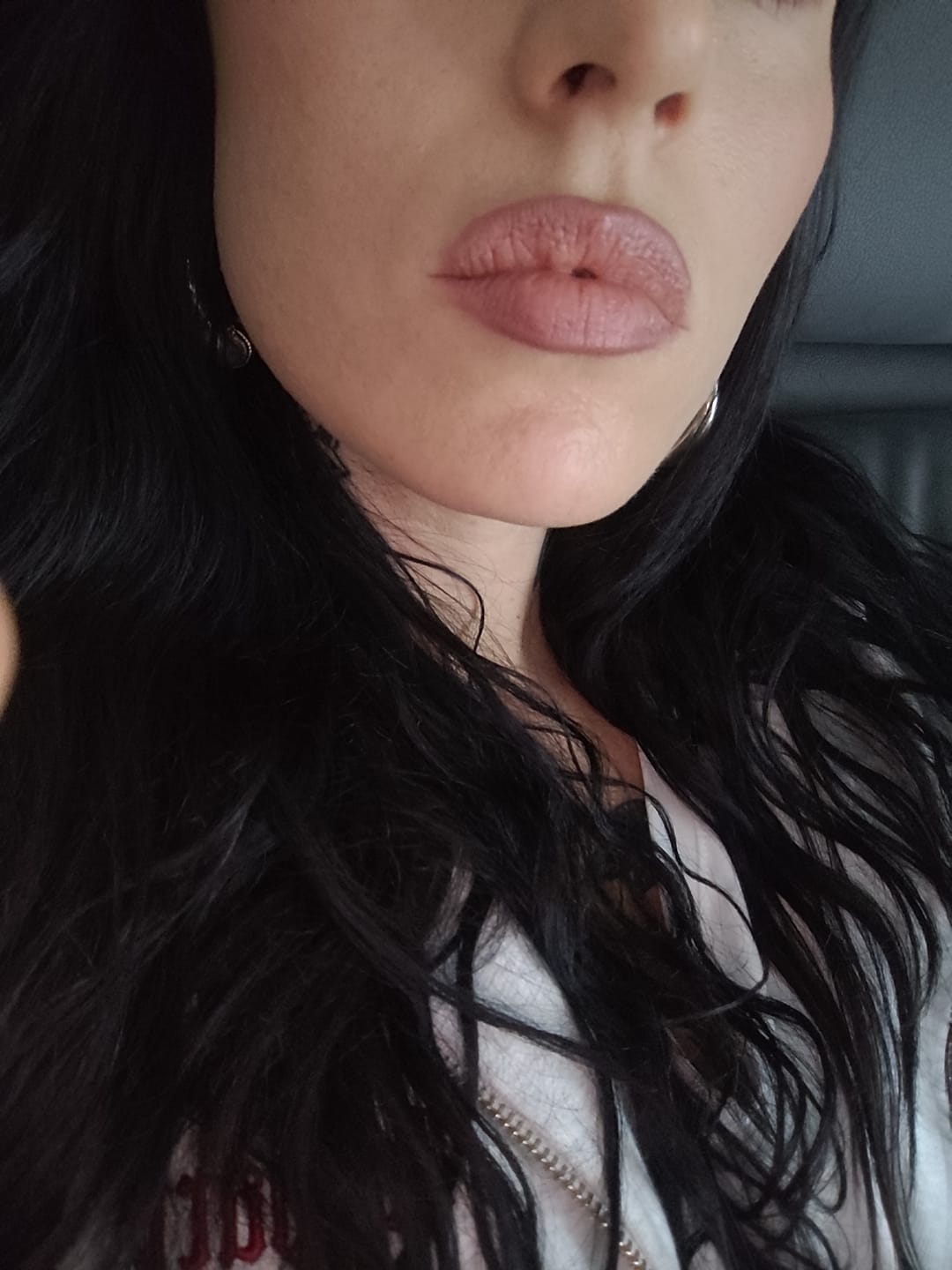 Customer photo review of A CONTROL - ACNÉ HORMONAL & RESISTENCIA A LA INSULINA