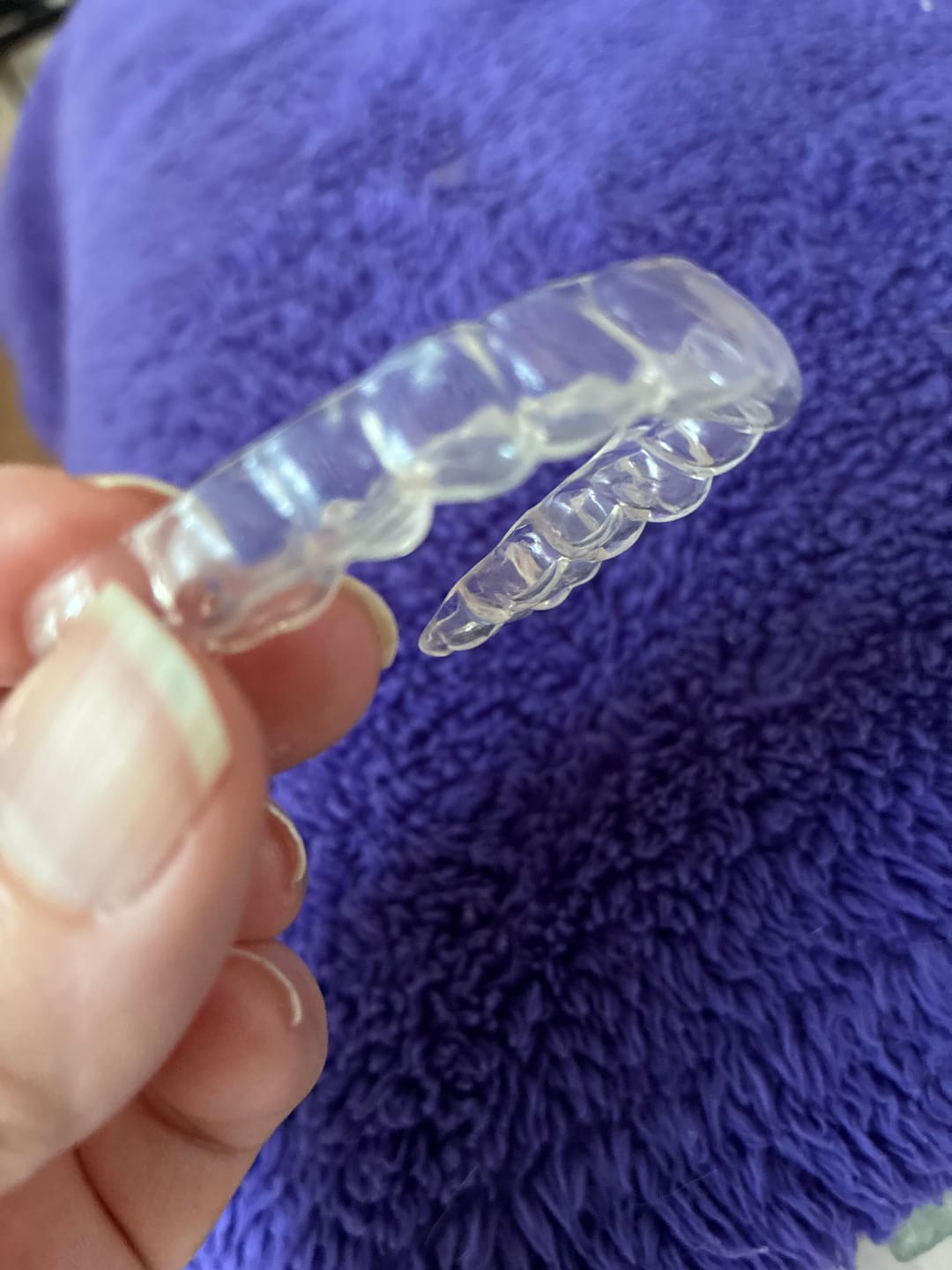 Customer photo review of Clear Custom Night Guard