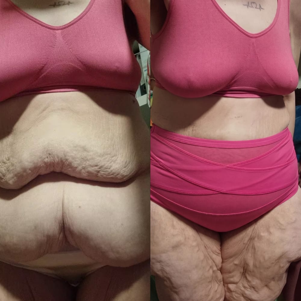 Customer photo review of Bremaris™ Faja Moldeadora