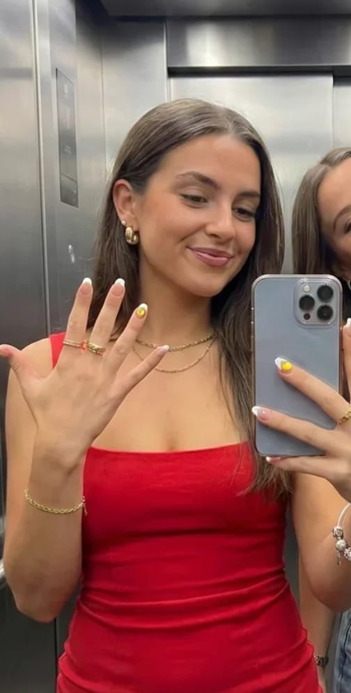 Customer photo review of Drink Testing Nail Stickers – Discreet Drink Spike Test