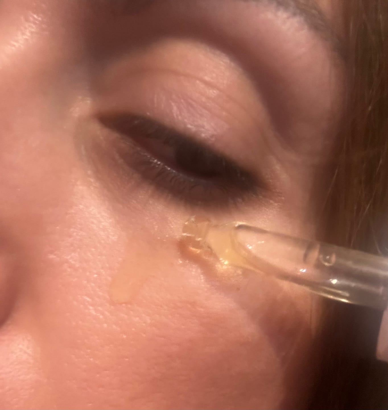Customer photo review of Eye Revival+ | Рутина за тъмни кръгове, подпухване и фини линии
