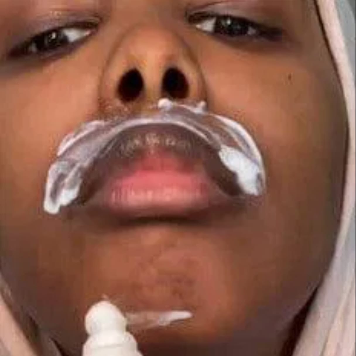 Customer photo review of Facial Hair Removal Kit
