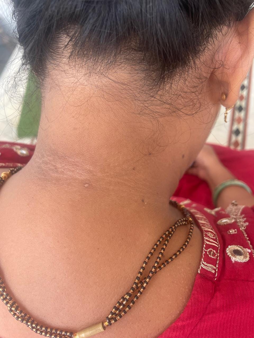 Customer photo review of Grabello Kojic Acid & Turmeric De-Tan Body Glow Spray Buy 1 Get 1 Free