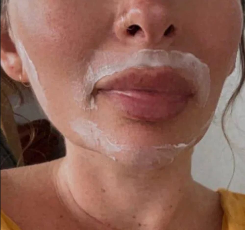 Customer photo review of Facial Hair Removal Kit