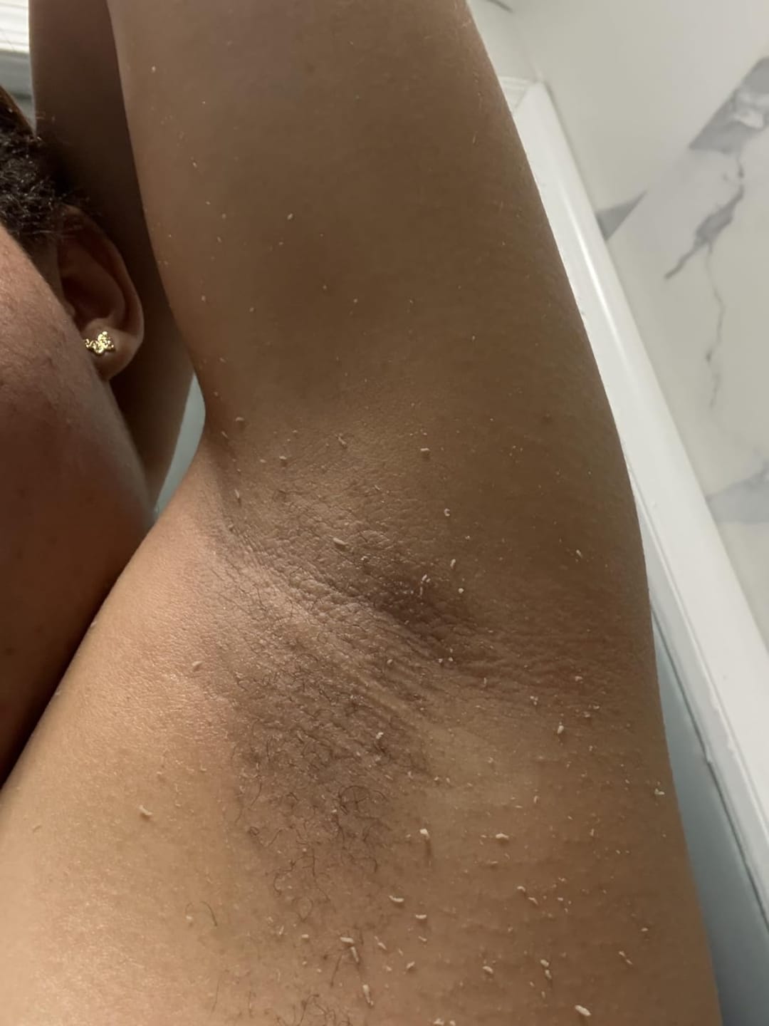 Customer photo review of Grabello Kojic Acid & Turmeric De-Tan Body Glow Spray Buy 1 Get 1 Free
