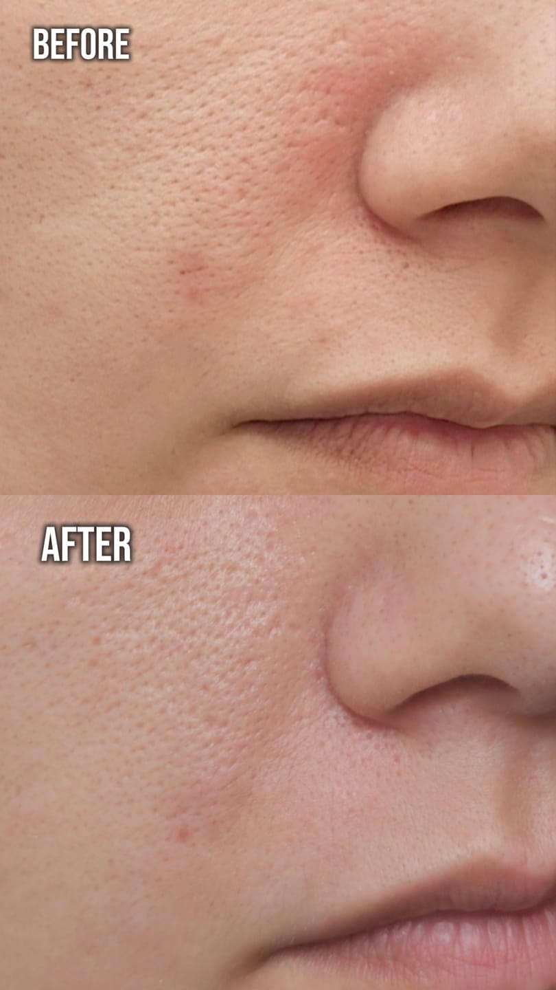 Customer photo review of EGF Blue Youth Activating Drop | EGF Peptide Serum